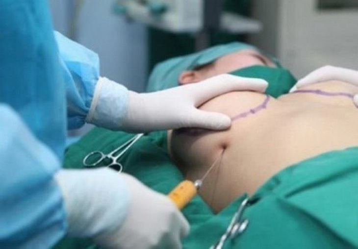 Sau nâng ngực chị em đối diện với nhiều nguy cơ.